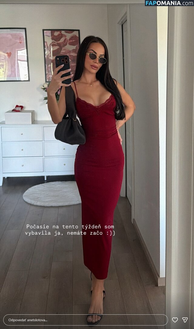 Anet Slotova / anetslotova Nu OnlyFans  Photo fuitée #1